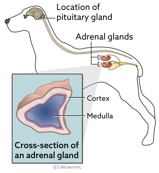 Addison Disease