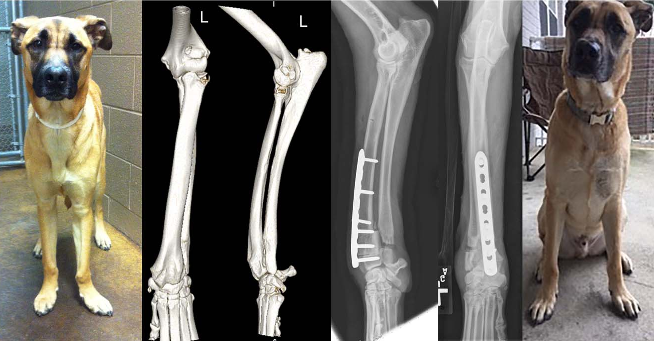 Angular Limb Deformity