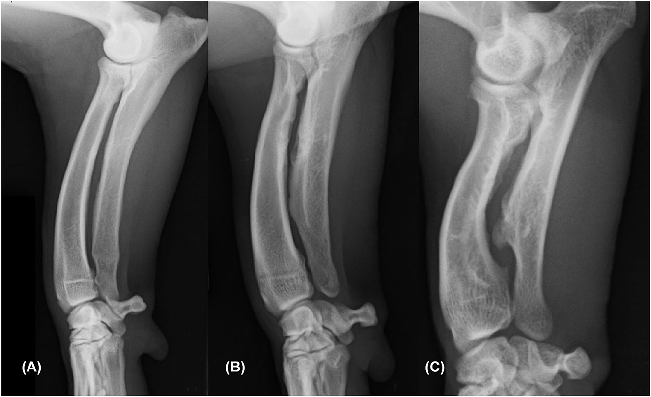 Angular Limb Deformity