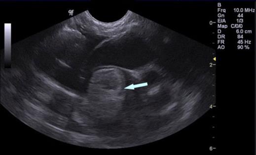 Aortic Thromboembolism in Cats