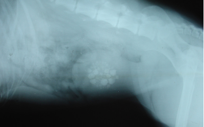 bladder stones