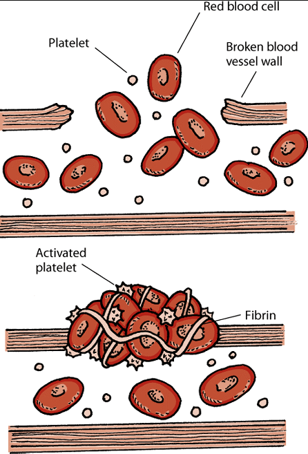 Bleeding Disorder