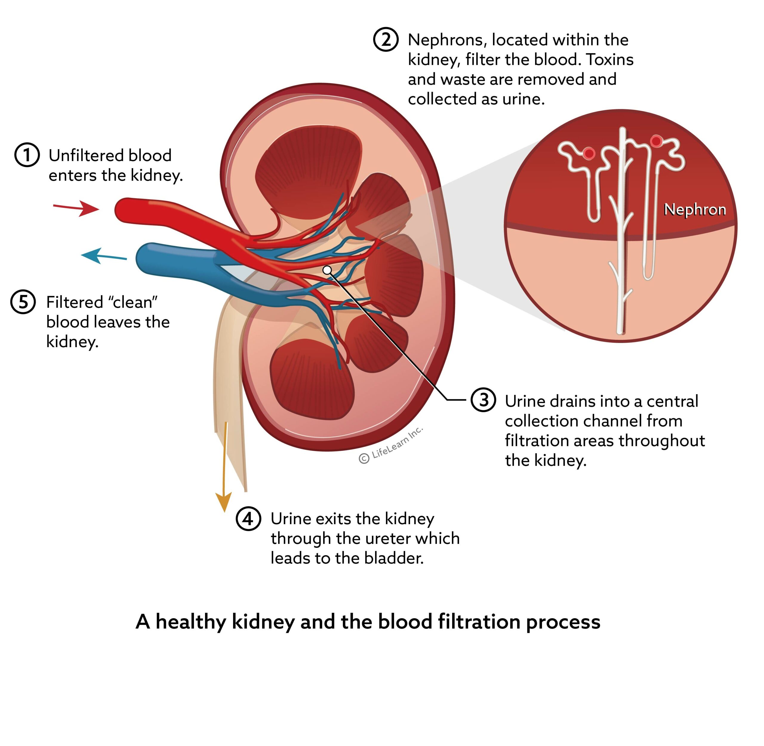 Chronic Kidney Disease in Dogs