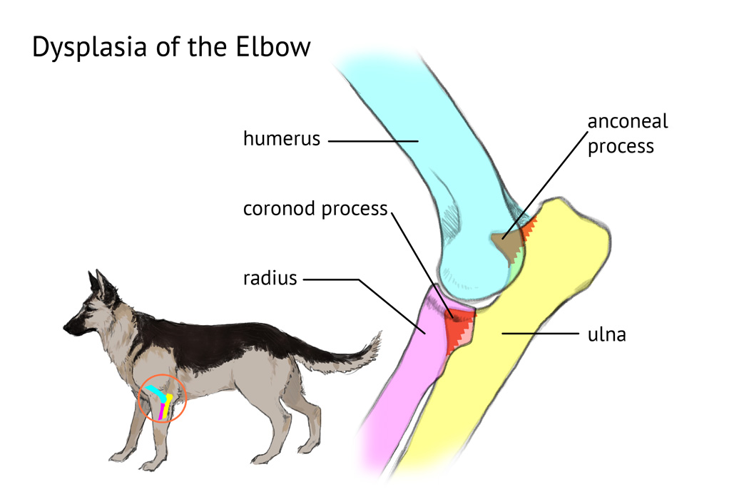 Elbow Dysplasia