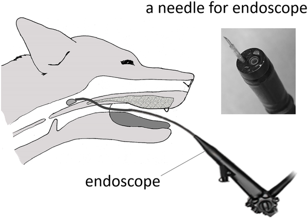 Endoscopy