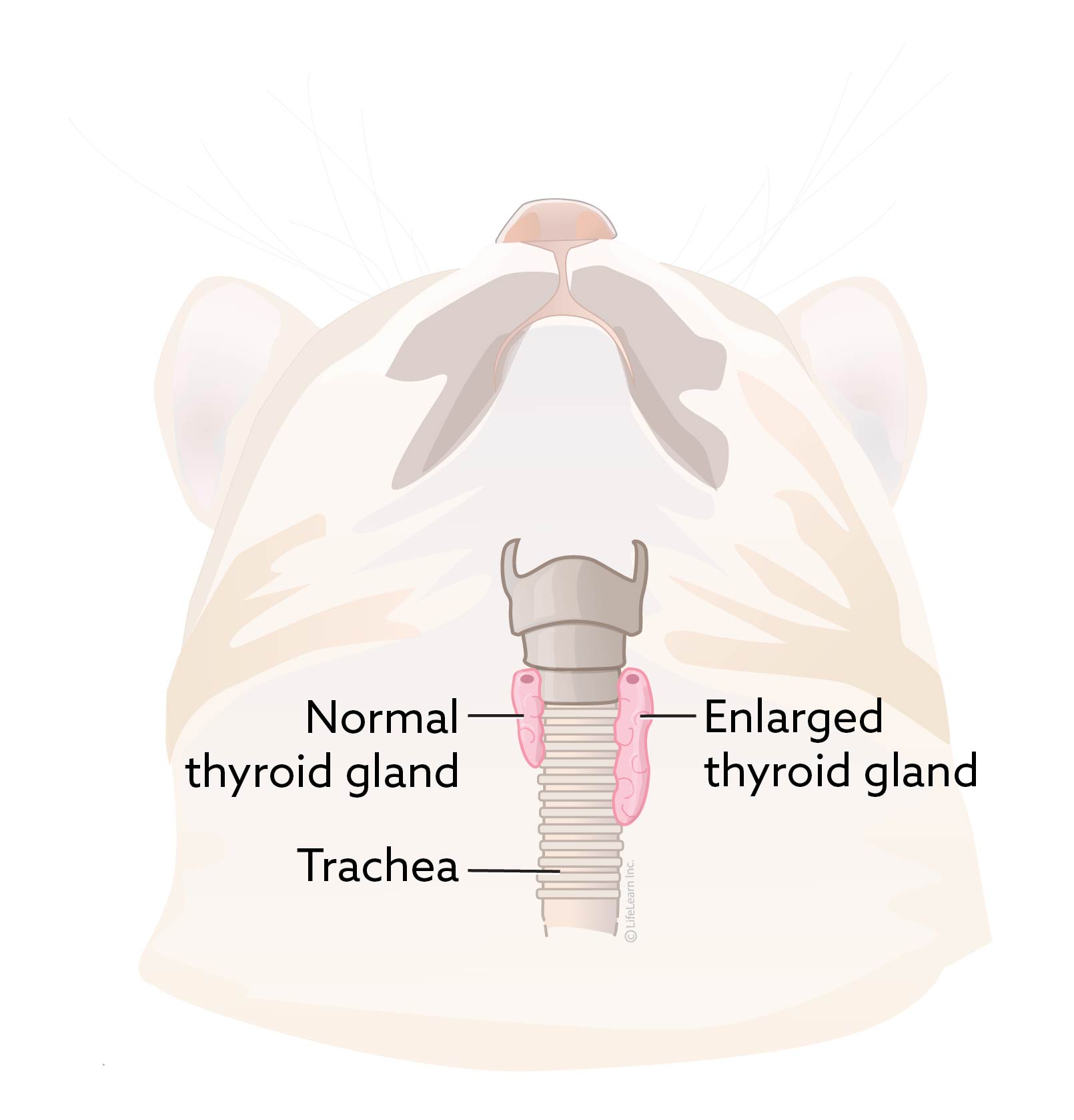 Feline Hyperthyroidism