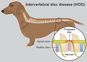 Intervetebral Disc Disease