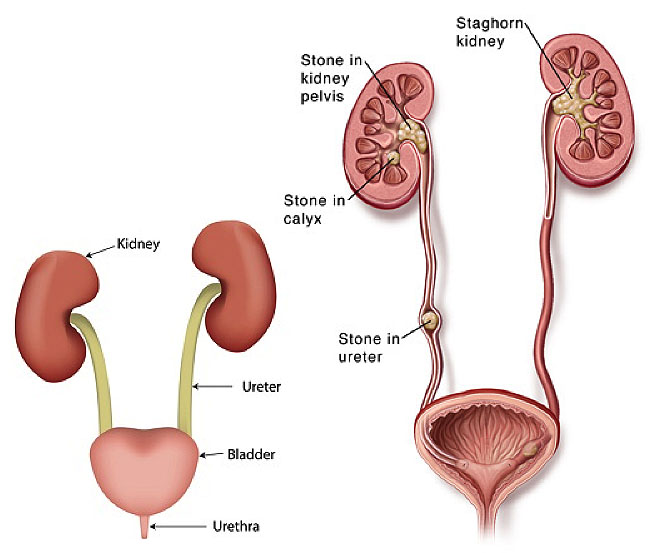 Kidney Stones in Dogs