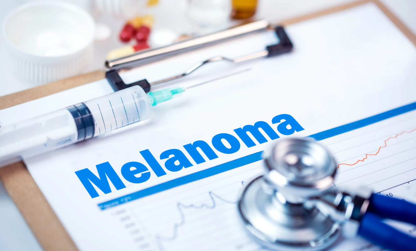 Melanoma Vaccine