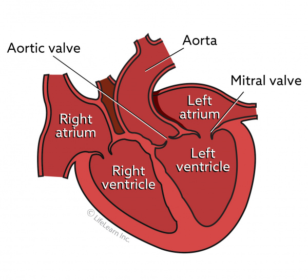 Mitral Valve Disease in Dogs