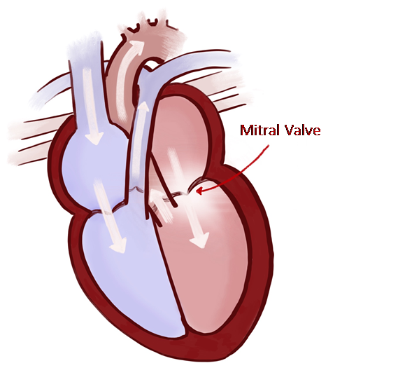 Mitral Valve Disease in Dogs