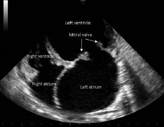 Mitral Valve Disease in Dogs