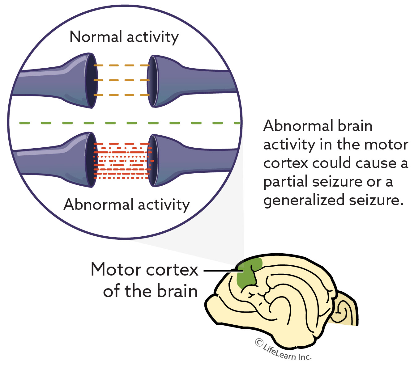 Neurological Assessment