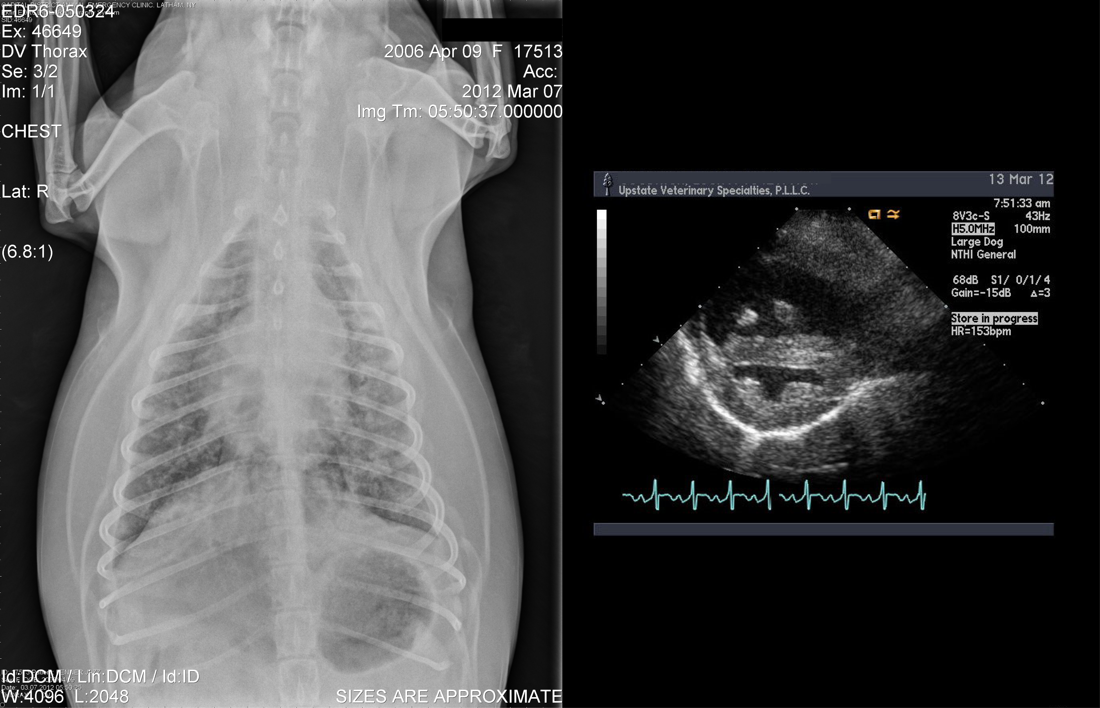 Pulmonary Hypertension