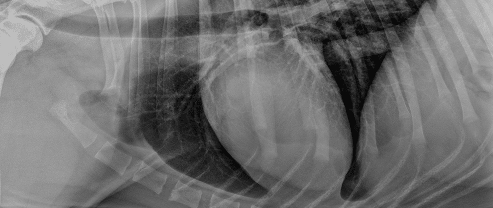 Pulmonary Hypertension