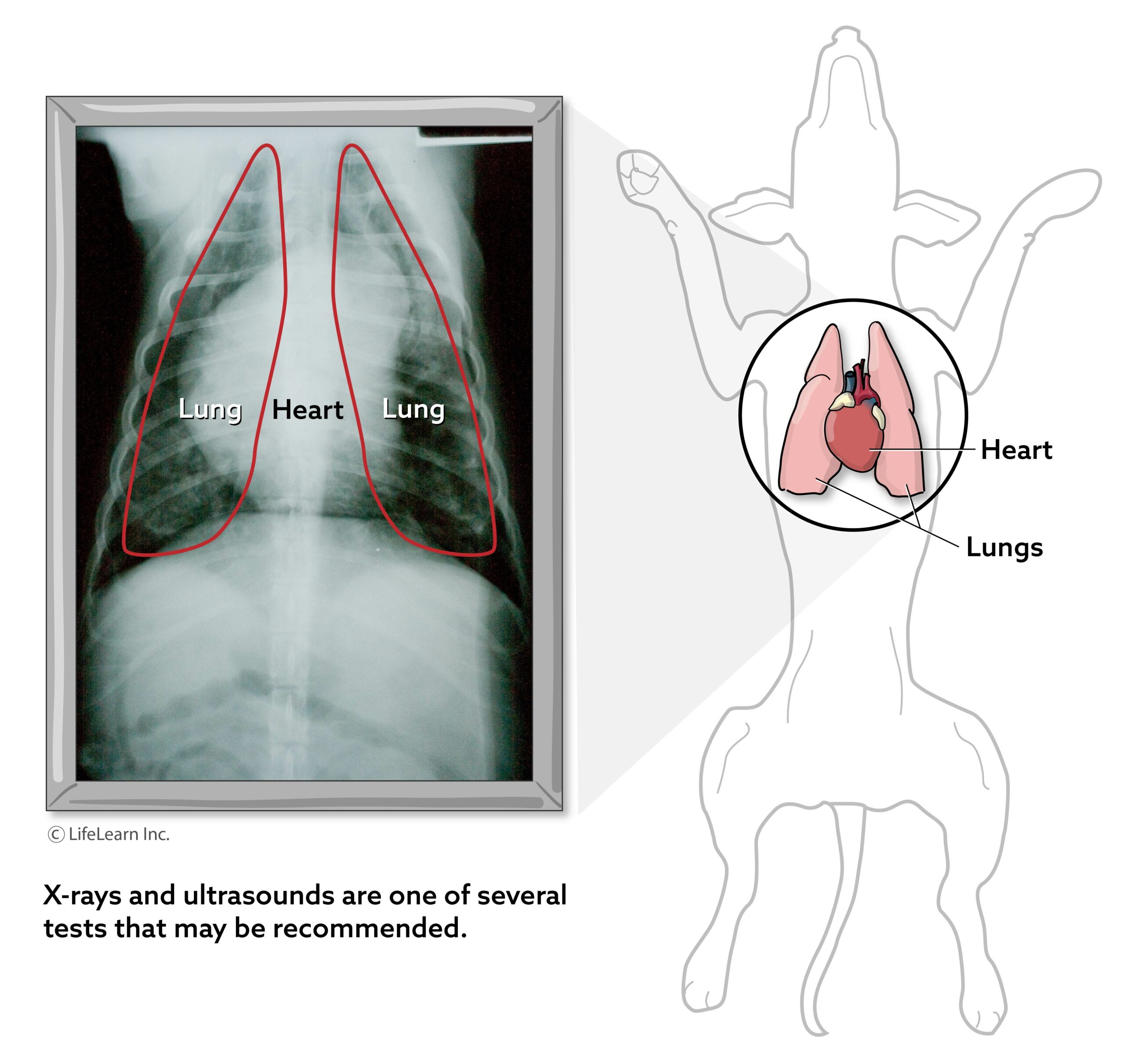 Ultrasound