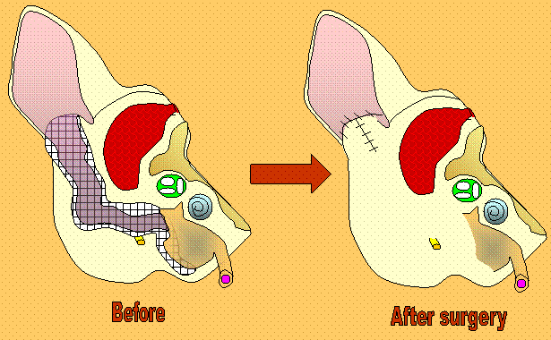 Total Ear Canal Ablation and Bulla Osteotomy