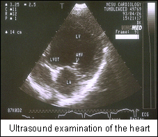 Ultrasound